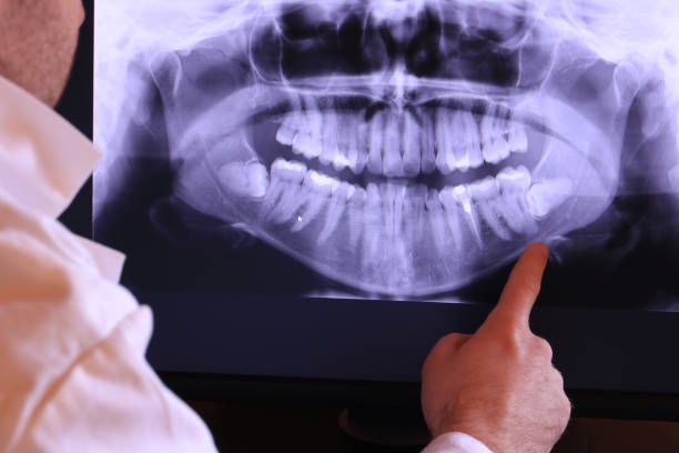 Best Emergency Root Canal Therapy in Hancock, MI